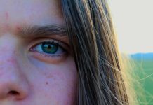 Zece alimente care, consumate în exces, sunt dăunătoare pentru pielea ta